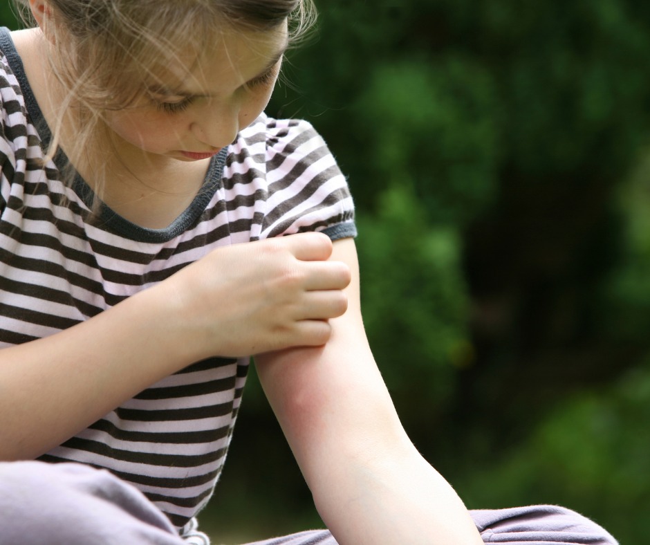 Piqûres d'insectes chez l'enfant : quand s'inquiéter ? (partie 1)